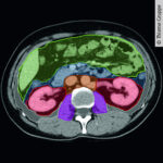 Peritoneale und retroperitoneale Anatomie für Radiologen